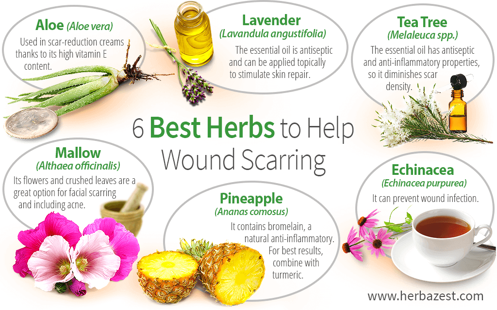 6 Best Herbs To Help Wound Scarring Herbazest 6 Best Herbs To Help Wound Scarring Herbazest