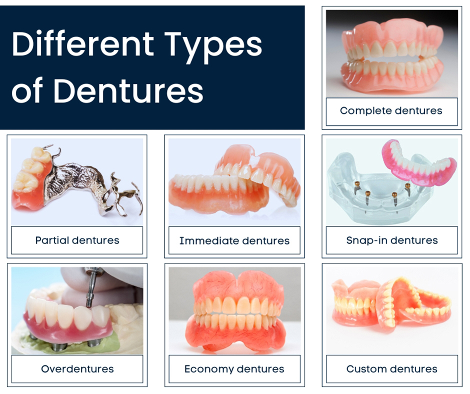 7 Different Types Of Dentures Which One Is Best For You Broadway 7 Different Types Of Dentures Which One Is Best For You Broadway