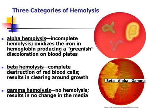 Alpha Beta Gamma Hemolysis Alpha Beta Gamma Hemolysis