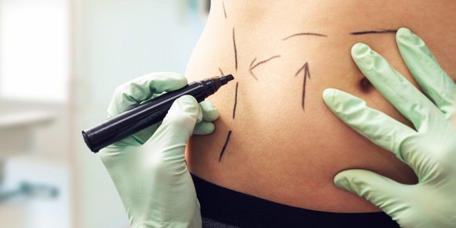 Best Liposuction Treatments Near Me Nj Lipoplasty Price Cost Best Liposuction Treatments Near Me Nj Lipoplasty Price Cost