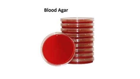 Blood Agar Composition Preparation Uses And Pictures Blood Agar Composition Preparation Uses And Pictures