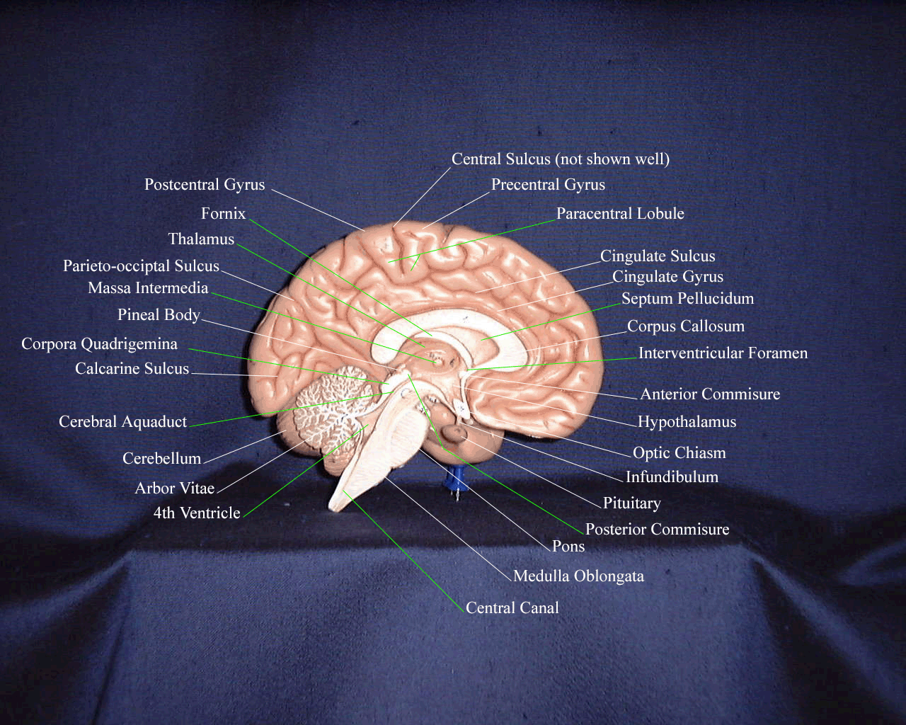 An Interactive Guide to Brain Models