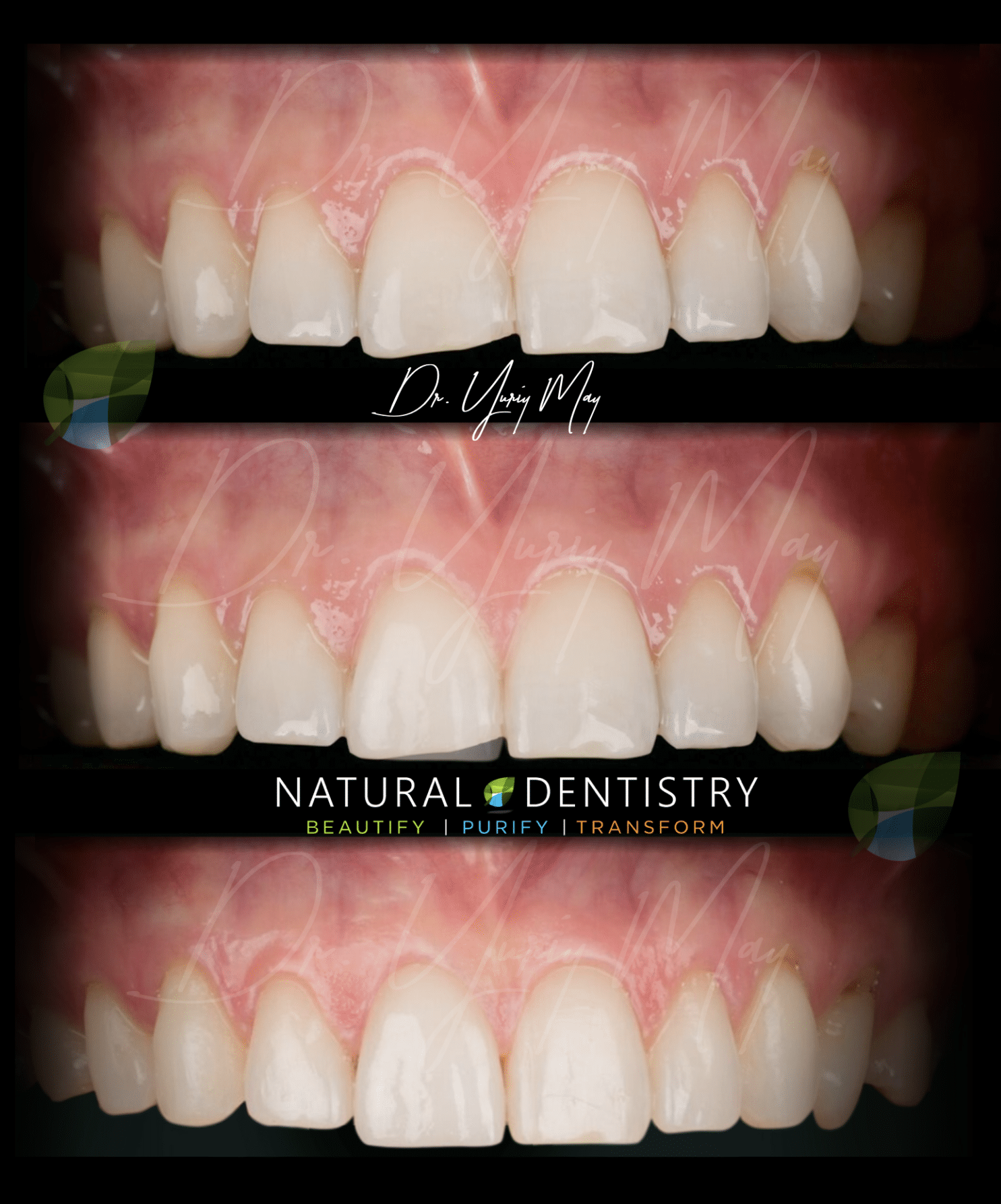 Cosmetic Pediatric Dentistry San Diego Medical Dental News Network Cosmetic Pediatric Dentistry San Diego Medical Dental News Network