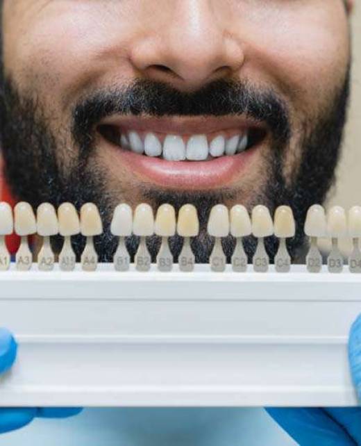 Dental Crowns Frederick Orthodontist Dublin 1 Dental Crowns Frederick Orthodontist Dublin 1