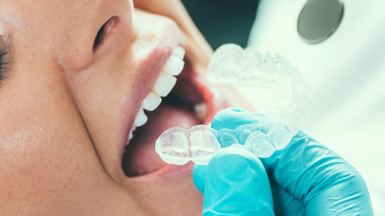Dental Implants Near Me Finding A Dentist In Ashburn Va