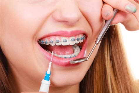 Dentist Braces Near Me