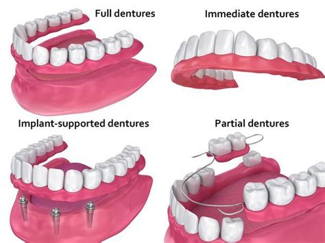 Dentists Near Me For Dentures