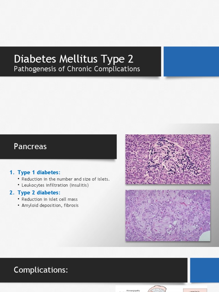 Diabetes Mellitus Type 2 Complications Biomedical Sciences And Diabetes Mellitus Type 2 Complications Biomedical Sciences And