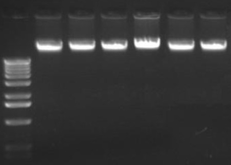 Dna And Gel Electrophoresis Dna And Gel Electrophoresis