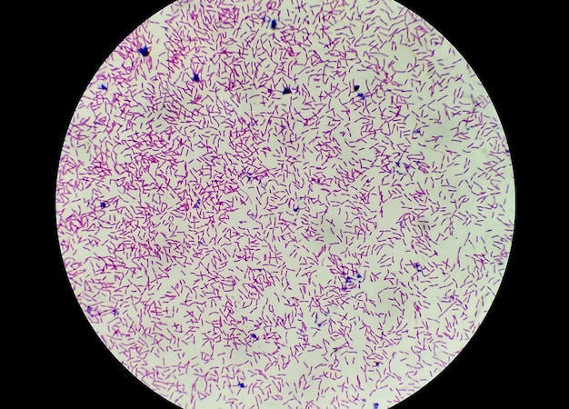 Isolated E Coli In Gram S Straining Microscopic Showing Gram Isolated E Coli In Gram S Straining Microscopic Showing Gram