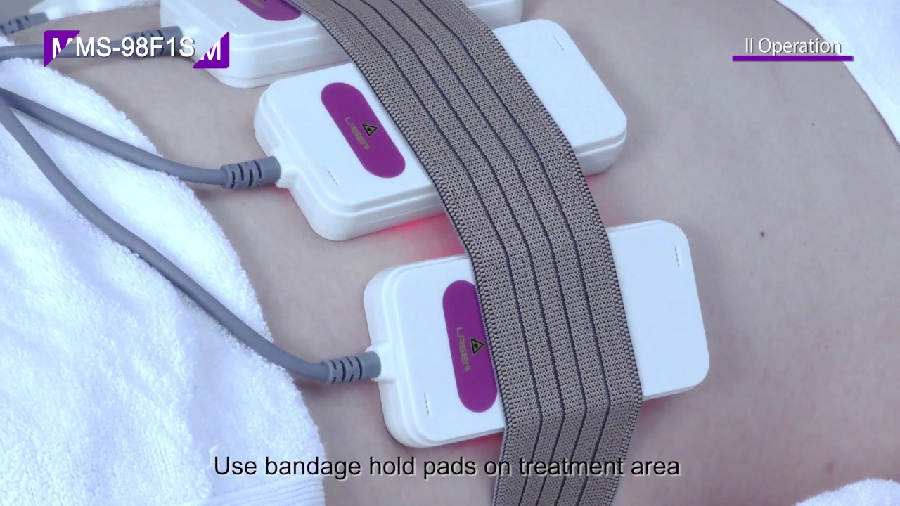 My Laser Lipo Cavitation Review Youtube My Laser Lipo Cavitation Review Youtube
