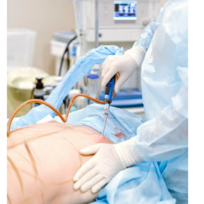 Post Op Lymphatic Massage Near Me Laser Lipo New York Strawberry Post Op Lymphatic Massage Near Me Laser Lipo New York Strawberry