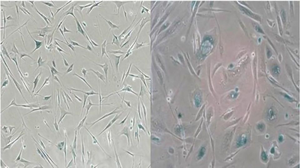Red Blood Cells As Biomarkers Of Aging Lifespan Io