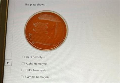 Solved This Plate Shows Beta Hemolysis Alpha Hemolysis O Chegg Com Solved This Plate Shows Beta Hemolysis Alpha Hemolysis O Chegg Com