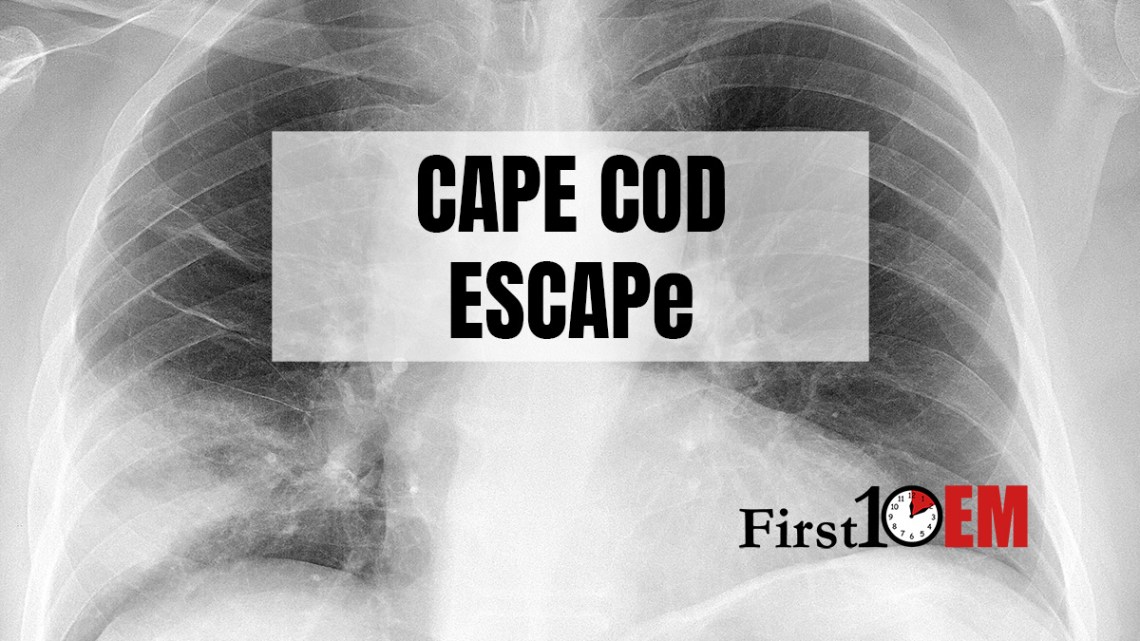 Steroids For Pneumonia Cape Cod And Escape First10em Steroids For Pneumonia Cape Cod And Escape First10em