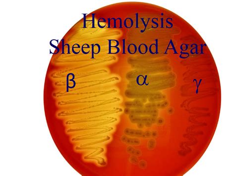 This Sheep Blood Agar Plate Shows Beta Alpha And Gamma Hemolysis This Sheep Blood Agar Plate Shows Beta Alpha And Gamma Hemolysis
