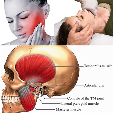 Tmj Massage Near Me