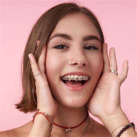 Types Of Braces Top Rated Dentist In Etobicoke Types Of Braces Top Rated Dentist In Etobicoke