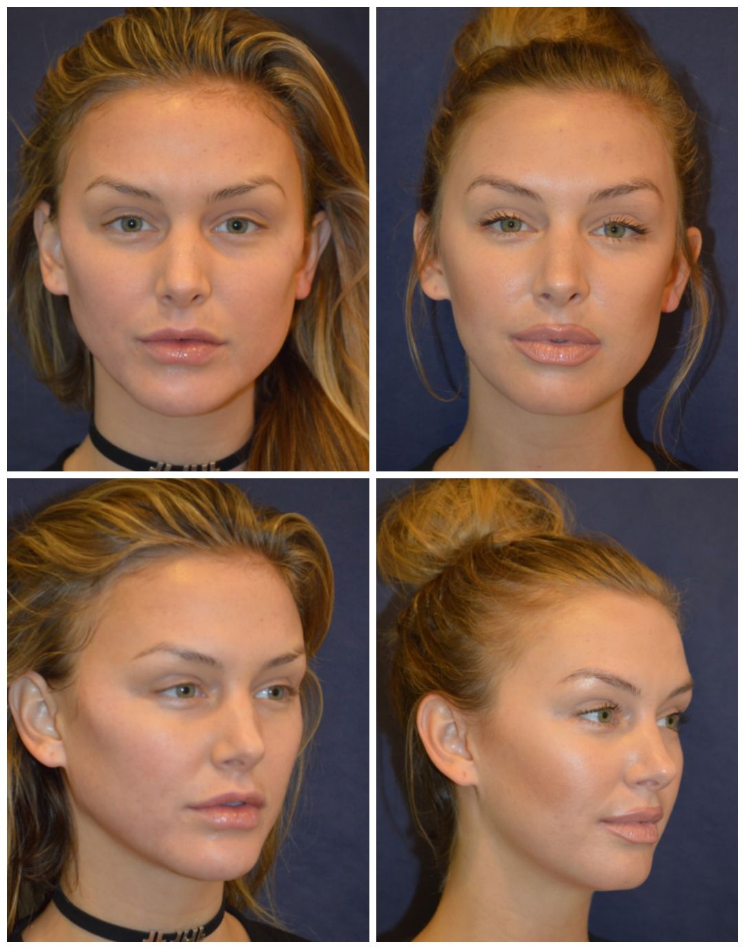 Unveiling Lala Kent The Journey Before Vanderpump Rules Unveiling Lala Kent The Journey Before Vanderpump Rules